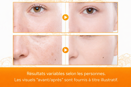 ✨ CURCUMA ÉCLAT™ – Huile-Sérum Visage au Curcuma 10 ml | Éclat & Peau Lissée | Nathy Boutiques